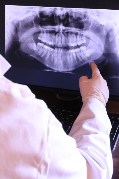 Best Root Canal Emergency Dentist  in Tieton, WA